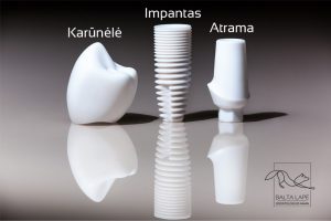 Dantų implanto visos sudedamosios dalys